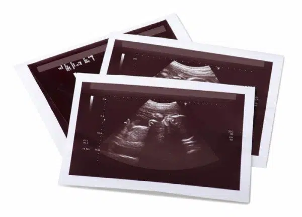 Ultrasound Thermal Paper Rolls