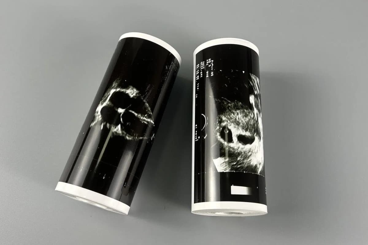 Ultrasound Thermal Paper Rolls